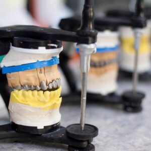 Suction Denture